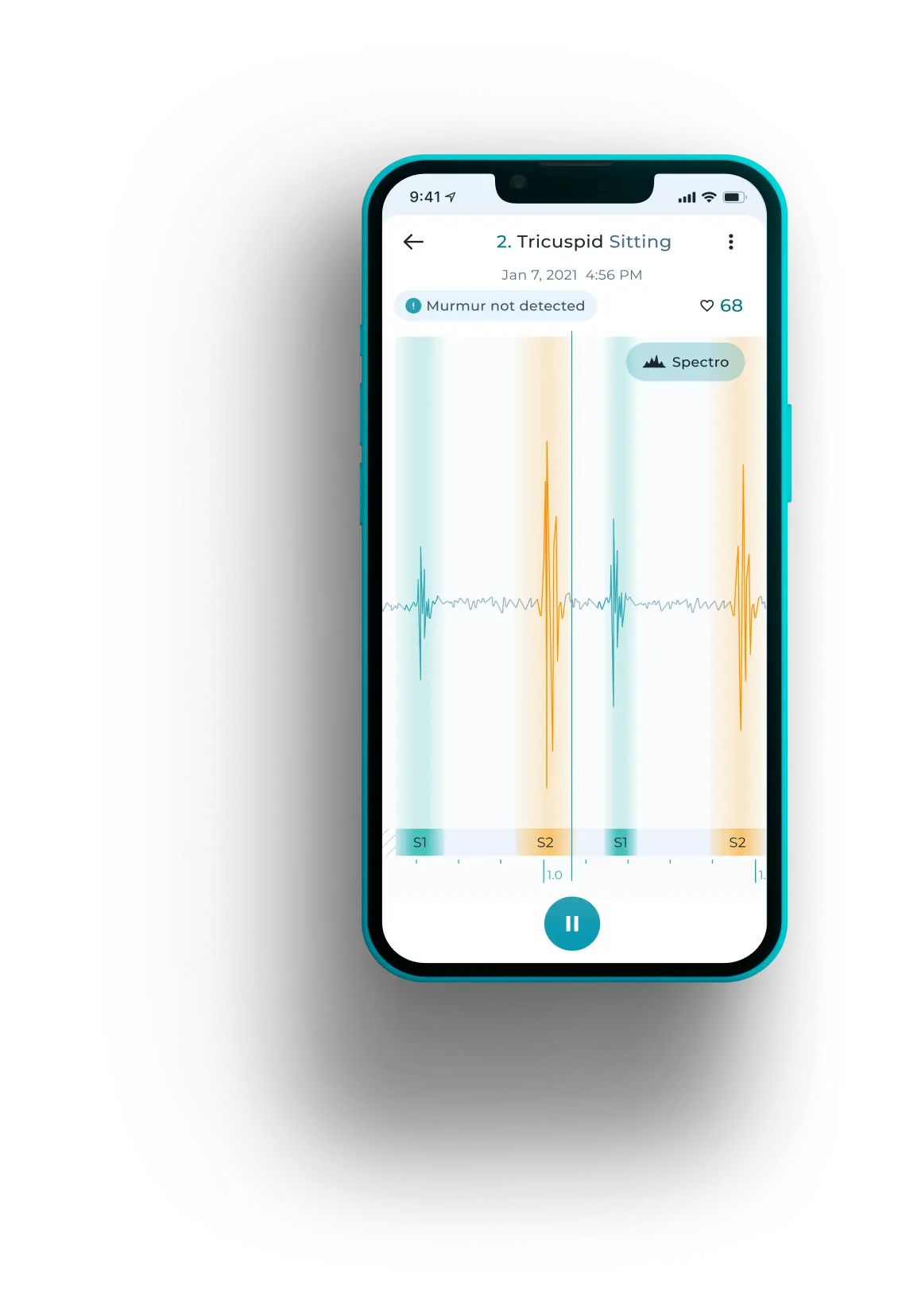 Smartphone displaying cardiac spectrogram analysis